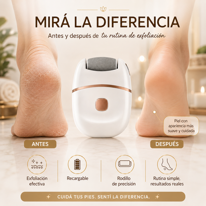 FOOTGLOW™ EXFOLIANTE RECARGABLE — TALONES MÁS SUAVES EN CASA ✨⚡ OFERTA ESPECIAL