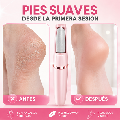 PEDISOFT™ Limador De Callos Recargable ⚡👣 Pies Suaves Sin Esfuerzo + Envío Gratis
