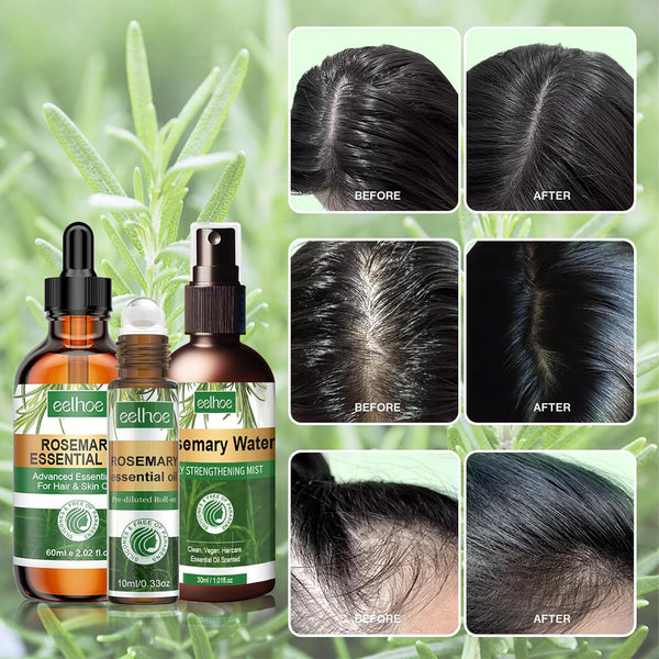 SPRAY VITALIZANTE DE ROMERO - (Tratamiento orgánico)